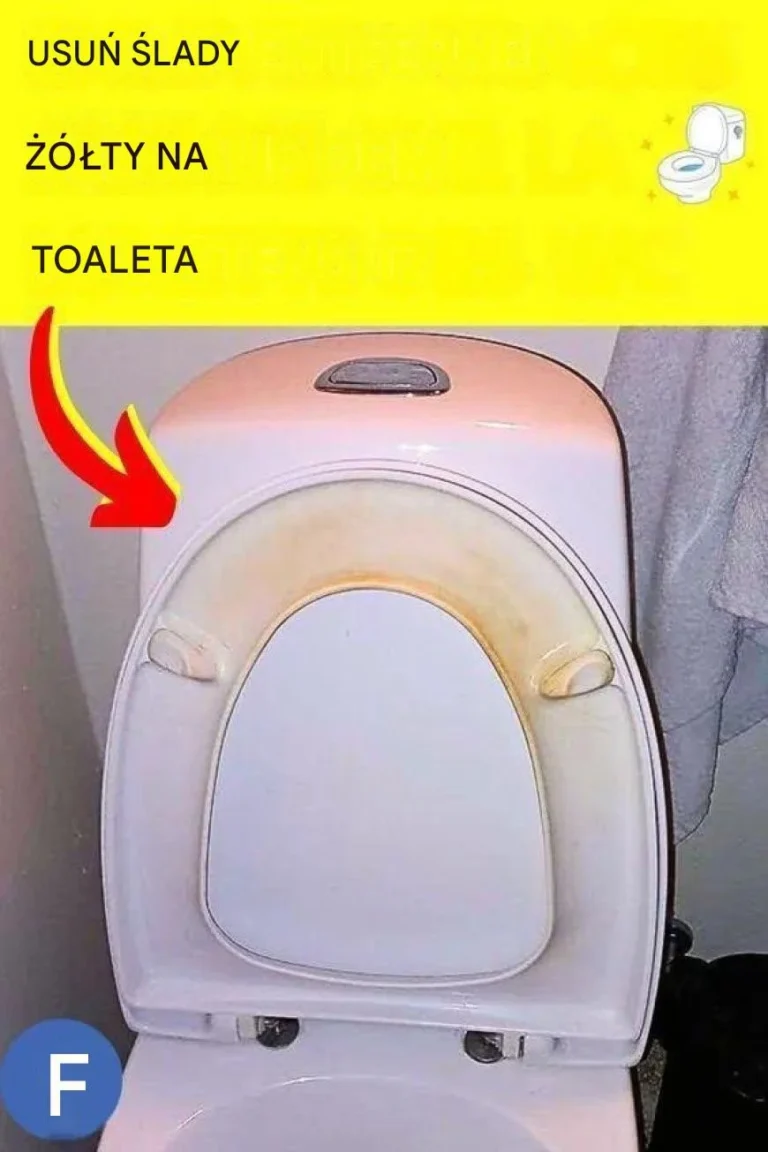 Jak usunąć żółte plamy z deski sedesowej