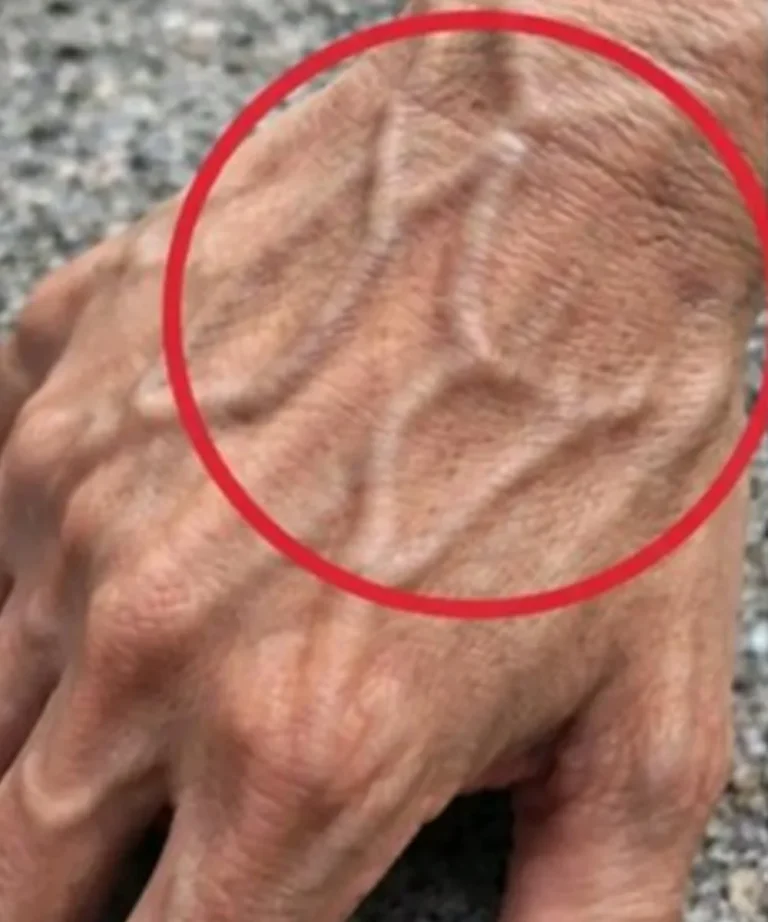 Jeśli masz widoczne żyły, oznacza to, że…