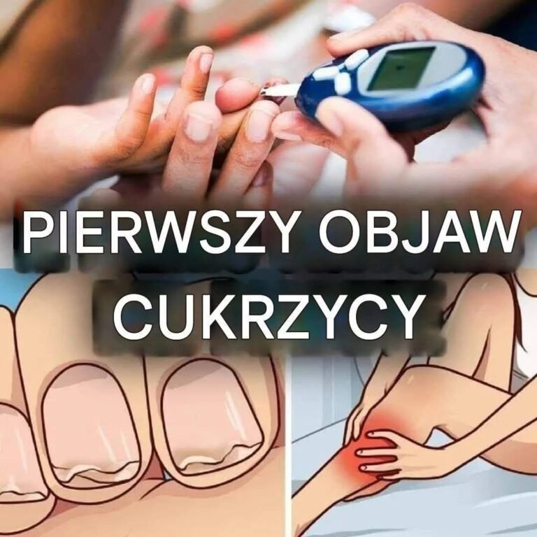 Oto najbardziej zaskakujące objawy cukrzycy (1 / 3)