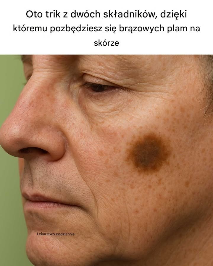 Oto dwuskładnikowy trik na pozbycie się brązowych plam na skórze
